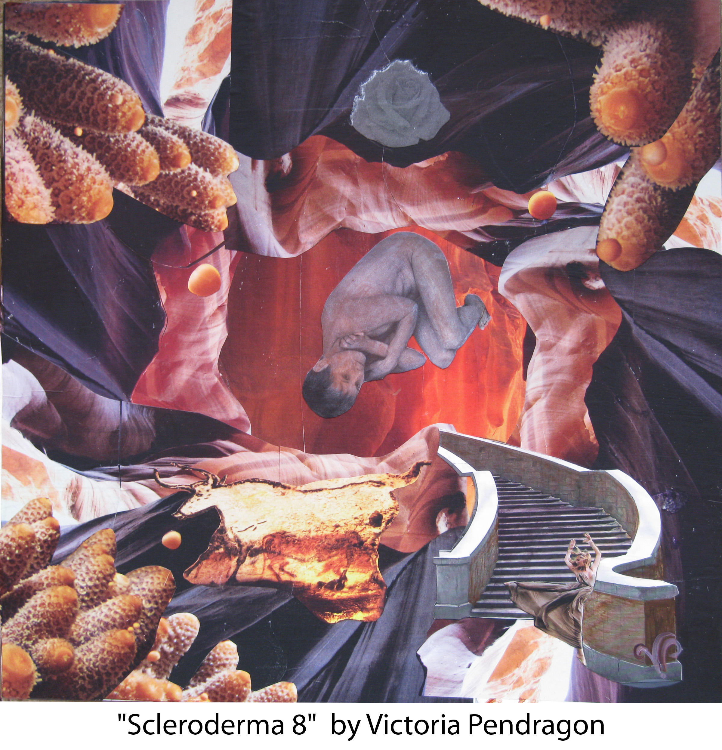 Scleroderma 8 by Victoria Pendragon